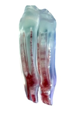 Endodontic Tooth Model: Mandibular Cheek tooth