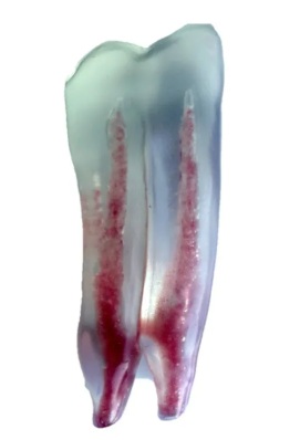 Endodontic Tooth Model: Mandibular Cheek tooth - Image 2